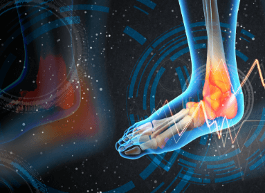 Heel Pain